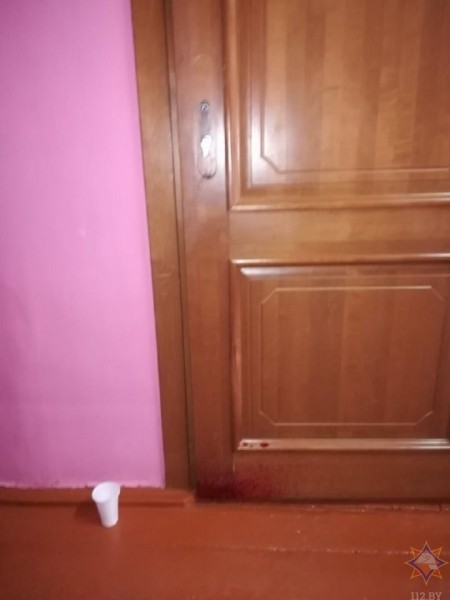 В Березе школьник пробил предплечье дверной ручкой