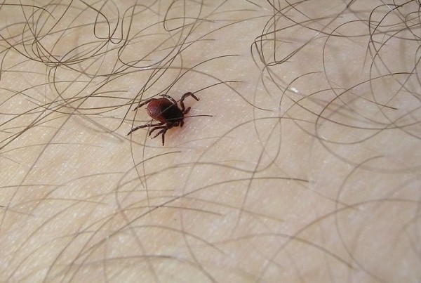 За 5 месяцев на Брестчине более 550 человек обратились к медикам из-за укусов клещей. Алгоритм действий при укусе клеща За 5 месяцев на Брестчине более 550 человек обратились к медикам из-за укусов клещей. Алгоритм действий при укусе клеща