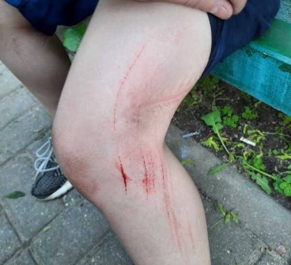 В Беларуси работники МЧС помогли мальчику, который застрял в приямке