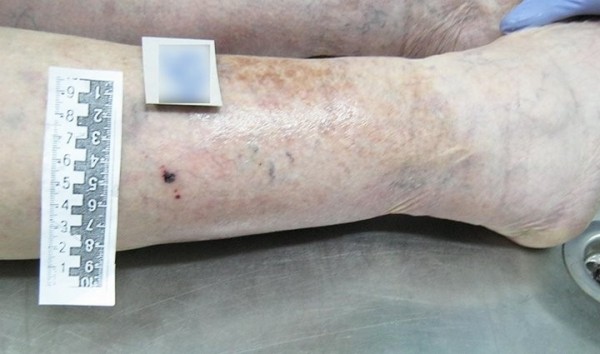 В Беларуси змея укусила на даче пенсионерку. Она умерла