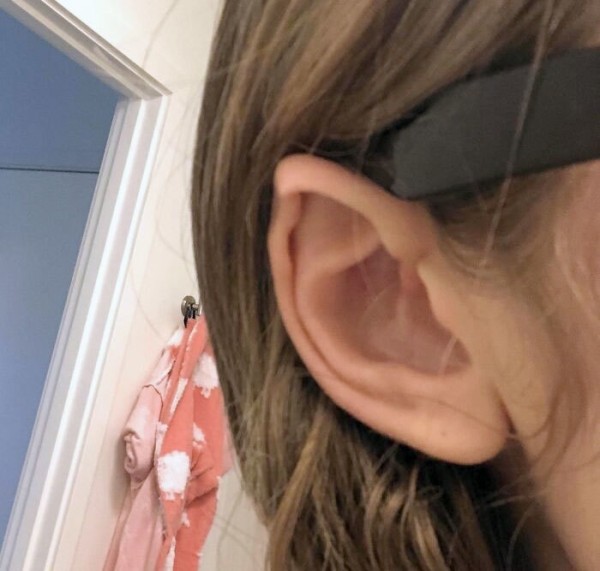 На этих фото показали, какие финты генетика вытворяет с людьми