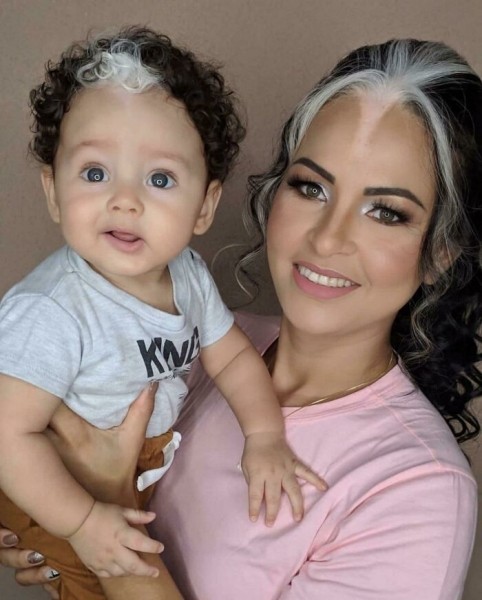 На этих фото показали, какие финты генетика вытворяет с людьми