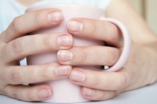 На ногтях появились белые полосочки. Это опасно? На ногтях появились белые полосочки. Это опасно?