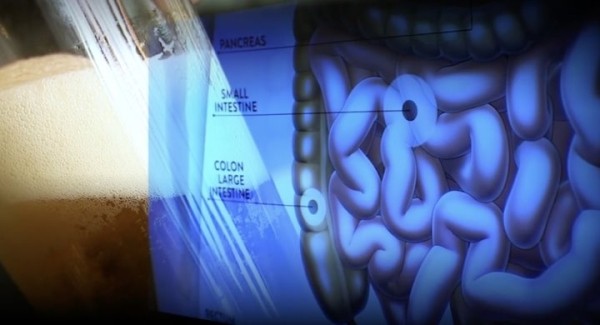 Редкий случай: организм мужчины стал сам вырабатывать спирт Редкий случай: организм мужчины стал сам вырабатывать спирт