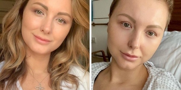 Умерла известный блогер Надя Мелешко. Она боролась с раком три года, за ее судьбой следили 500 тысяч человек Умерла известный блогер Надя Мелешко. Она боролась с раком три года, за ее судьбой следили 500 тысяч человек