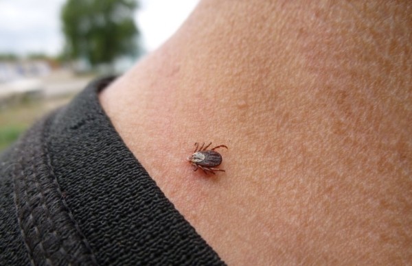«Очень важно вовремя удалить клеща». Белорусский врач рассказал, как проявляется клещевой боррелиоз