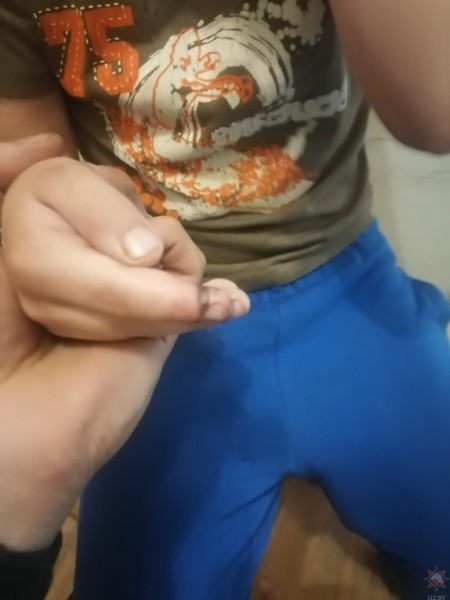 Спасатели помогли мальчику освободить палец из велосипедной цепи Спасатели помогли мальчику освободить палец из велосипедной цепи