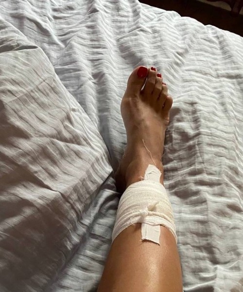 Минчанка начала день у открытого бассейна, а закончила в больнице. Как так вышло? Минчанка начала день у открытого бассейна, а закончила в больнице. Как так вышло?