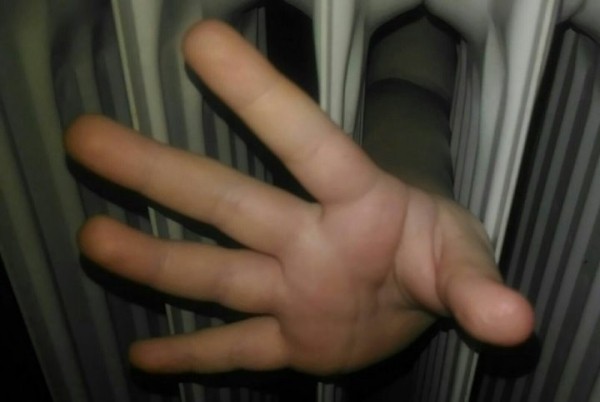 Рука брестской первоклассницы застряла в радиаторе отопления, на помощь пришли спасатели Рука брестской первоклассницы застряла в радиаторе отопления, на помощь пришли спасатели