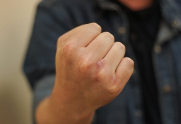 За избиение пенсионера, который требовал вернуть долг, осудили жителя Ляховичей За избиение пенсионера, который требовал вернуть долг, осудили жителя Ляховичей